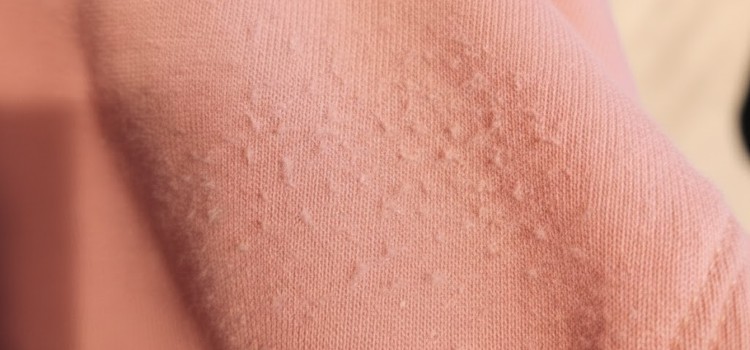 consejos evitar bolitas en pijamas